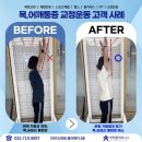 인천주안역피트니스 어깨운동으로 통증 치료 및 체형교정 고객 후기