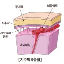 하에 Daum백과
