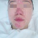 수앤수 | 피부염 홍조 문제성피부가 선택한 수앤수쇼룸 쇼핑 내돈내산 솔직 후기 에스테틱 제품으로 피부 루틴...