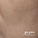 송내에스테틱 트리플관리 를 받아본 엘로이테라피 체험 후기