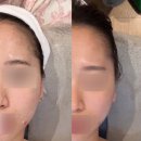 (주)시흥에너지 | [경기/배곧] 시흥피부관리 "차올라에스테틱" 아프지 않은 에너지 윤곽관리 솔직 후기
