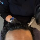 5857 | 김포 장기동 두피관리 탈모관리 맛집 웰킨두피탈모센터 김포장기점 솔직 후기 진짜진짜 추천