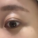 오렌즈비젼센터홍대점 이미지