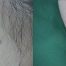 더지움의원 이미지