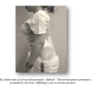 고려보조기 이미지