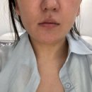 빌리브메디칼 | 대구죽전역 윤곽관리 작은얼굴관리 잘하는 스킨룸헤레