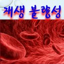 사암침, 사암침법 - 재생불량성 빈혈 치료 방법 - 비과학적 양의학 105 이미지