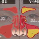 안코비어 이미지