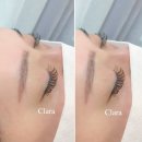 클라라뷰티라인 이미지