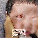 아기눈썹