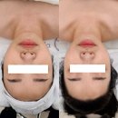 예뻐지다더플러스 | 전주웨딩관리 에코시티 송천동 작은얼굴관리 더예뻐지다에스테틱 방문후기