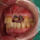 여치과기공소 이미지