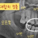 유천플란트치과 이미지