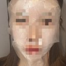 해통성준의원 | 잠실 블리비의원 리쥬란 + 스킨보톡스 솔직 후기