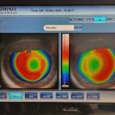 더베스트안경 이미지