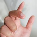 맑은내한의원 | 얼굴에 퍼지는 대구편평사마귀 하늘체한의원 치료 알아보고 비용 아낀 후기