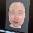 자연과한의원 수원 | 수원 안면비대칭 한의원 SP연예인 교정 1회 후기