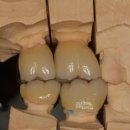 민치과기공소 이미지