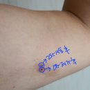 엔엑스티 | [피임시술] 임플라논 첫 시술 후 벌써 3년, 제거 및 재시술 간단 후기