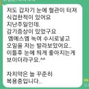 눈 혈관 터졌을때 이미지