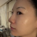 이연뷰티 - 영주시 대학로 189 | 김포 피부관리 이연 에스테틱 구래동 데콜테 림프 관리로 라인 정리 대만족 후기