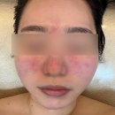 안스에스테틱 | 송도 안스에스테틱 피부관리 받고 온 후기