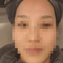 명지 피부관리 모공디톡스 올가드림뷰티명지 에스테틱 후기