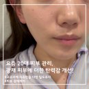 밀도 | 리쥬란에 고우리를 더한 20대 피부관리 NP밀도주사 후기