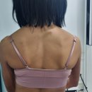 리앤비 | 강남체형교정 리앤비체형교정센터 상체교정 후기