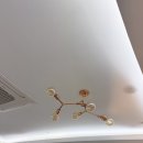 300 | 일산피부과 울쎄라300샷 후기