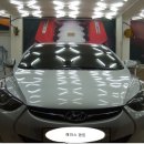 에이스덴트 이미지