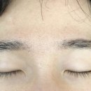 준호헤어라인 이미지