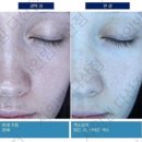 샤인빔의원다산점 네이버블로그