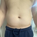 인계동 백성병원앞 | 수원 인계동 - 수원다이어트병원 '지방분해주사'(3회차)