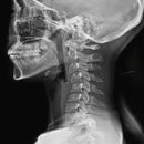 디포먼스 이미지