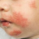 구대한의원 이미지