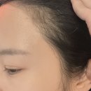 둔산헤어스케치 | 대전시청역 둔산동 바비라인smp헤어라인 1차 2차 후기