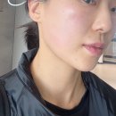 예비 신부관리 신사역 온다리프팅 전후 효과 솔직후기 들고왔어요