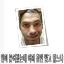 텅케어와 구안와사 이미지