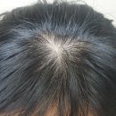헤어플러스 이미지