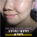 올가뷰티 - 남양주시 창현로 60 | 은평구 피부관리 올가뷰티 모공디톡스 수분물광케어 후기
