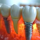 열린미소치과의원 이미지