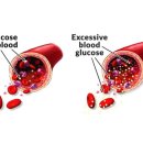 혈당지수 이미지