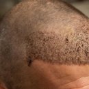 careful hair