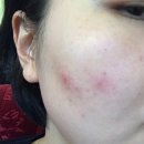 남포고운피부과의원 이미지