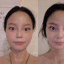 포톤체온관리센타 네이버블로그