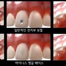 홀치과의원 이미지