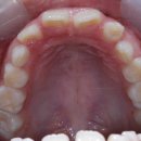 지엘치과기공소 이미지