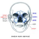 축농증의 코세척 및 테이핑 이미지