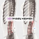 20 | 오산 세마역 필라테스 린 20대 여성 회원님 체형 변화 후기